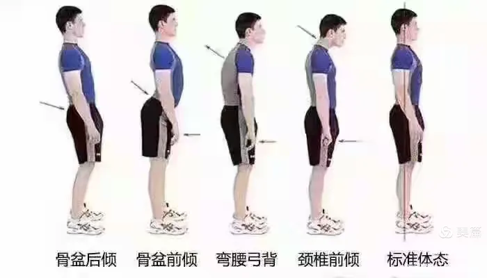 曲度